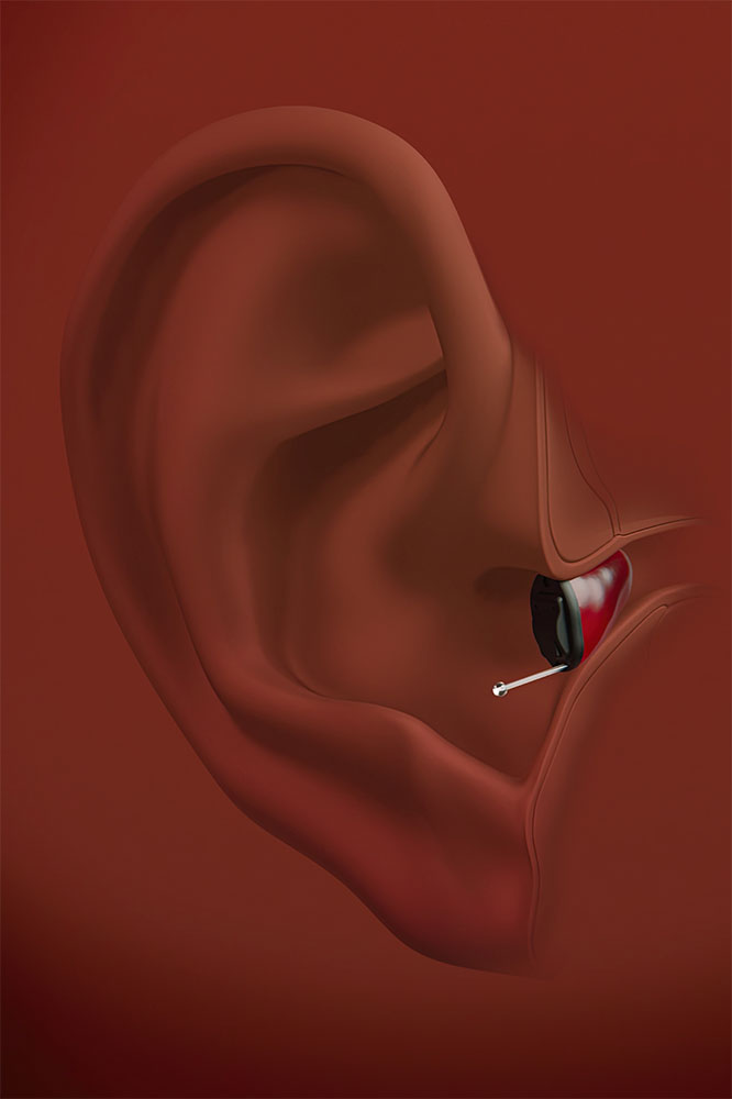 insio audiocare na orelha